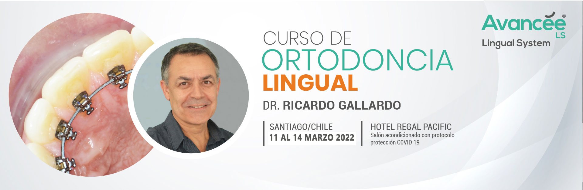 Curso Ortodoncia Lingual 2021