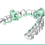 Diseño virtual de los jigs