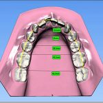 Análisis digital de modelos