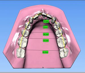 Análisis digital de modelos