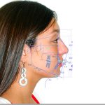 Cefalometría digital