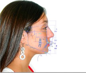 Cefalometría digital