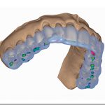 Planos de relajación