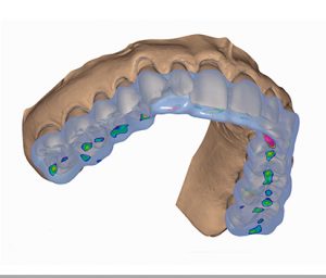 Planos de relajación